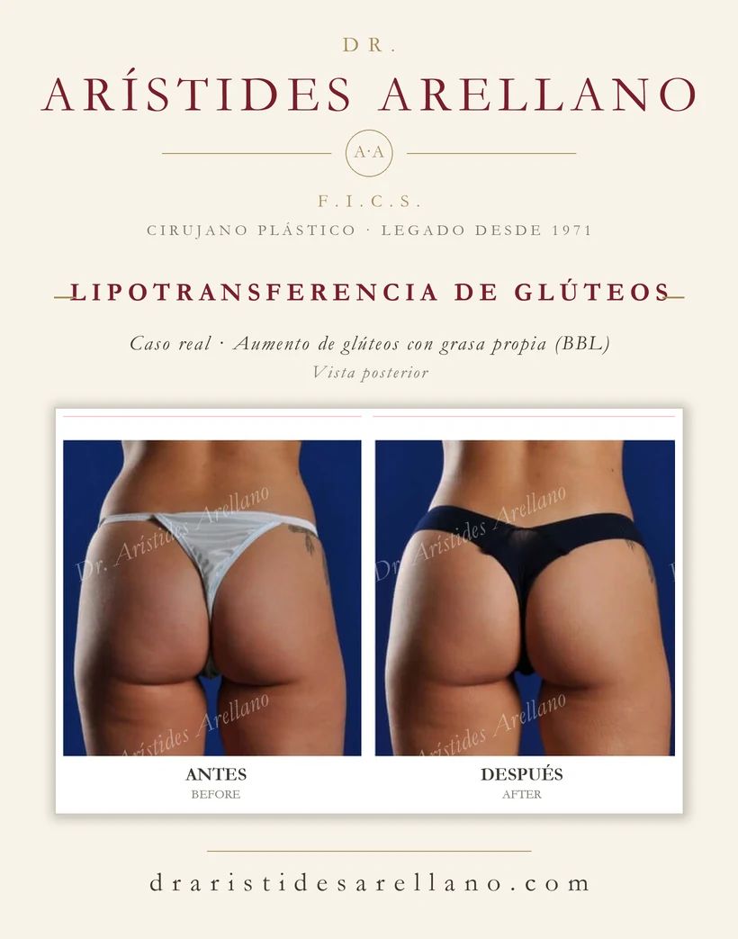 Arístides Arellano Huacuja-32