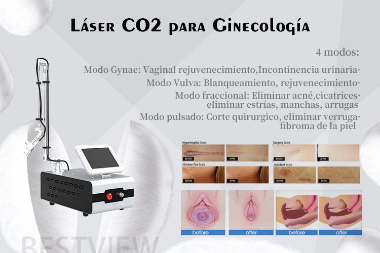 Guadalupe Muñoz Castro-70