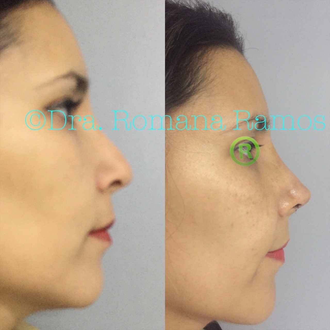 Romana Ramos Cárdenas-12