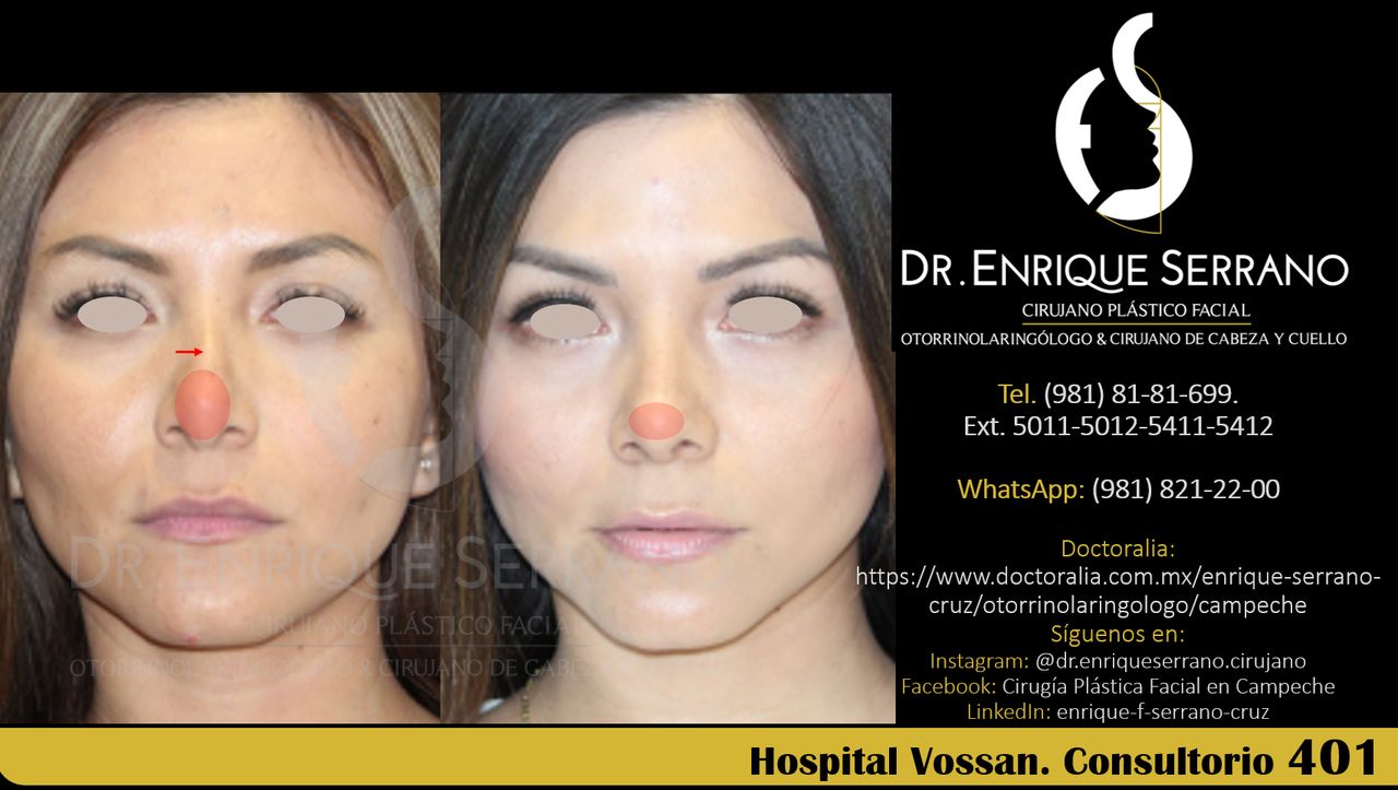 Enrique Serrano Cruz-112