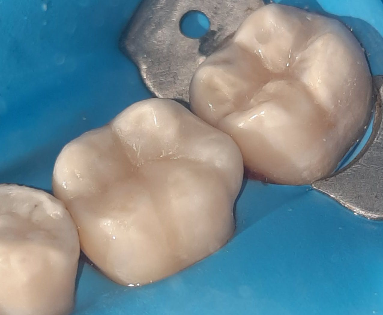 Oscar Justo Bustos-0