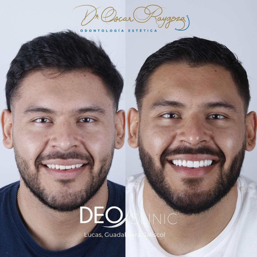 Oscar Raygoza Carrillo-39