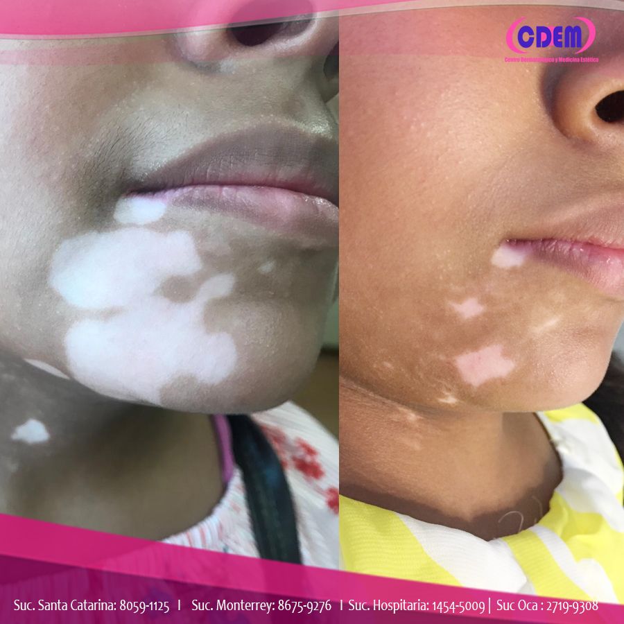 Mercedes Fernández Reyes-16