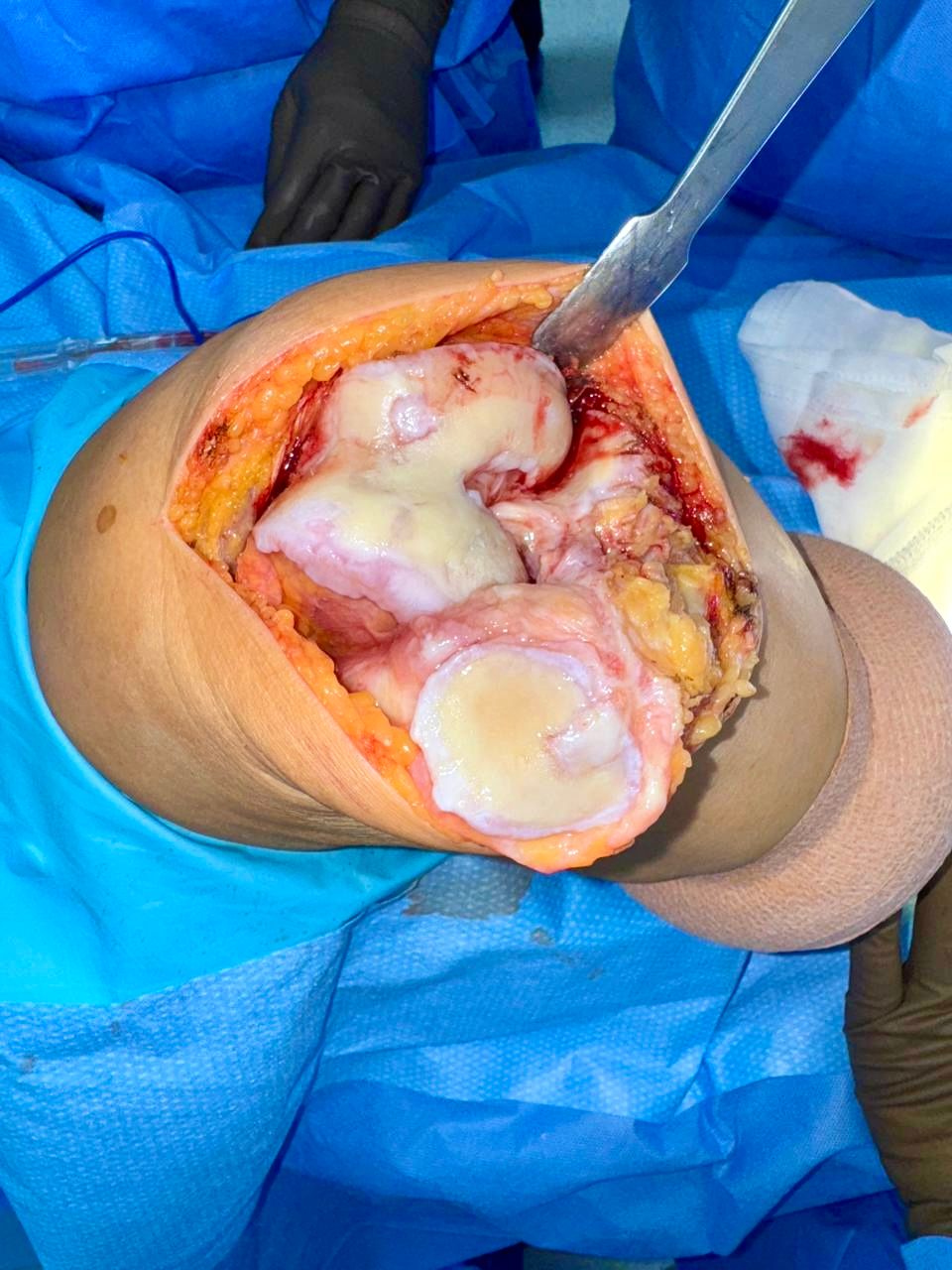 Monica Álvarez Cedeño-1