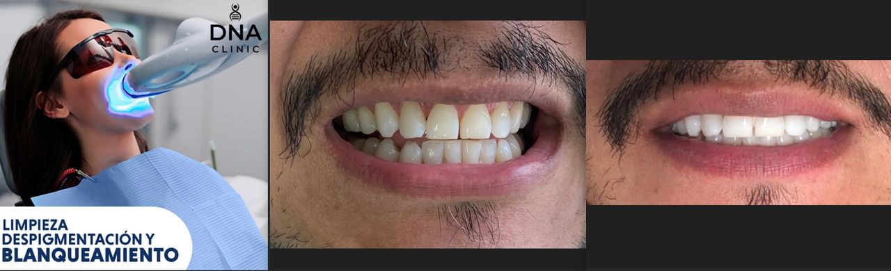 Angel Hermes Aguilar Orihuela-6