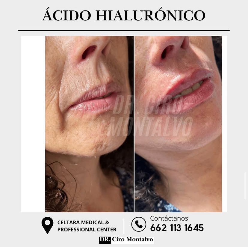 Ciro Alberto Montalvo Bojorquez-3