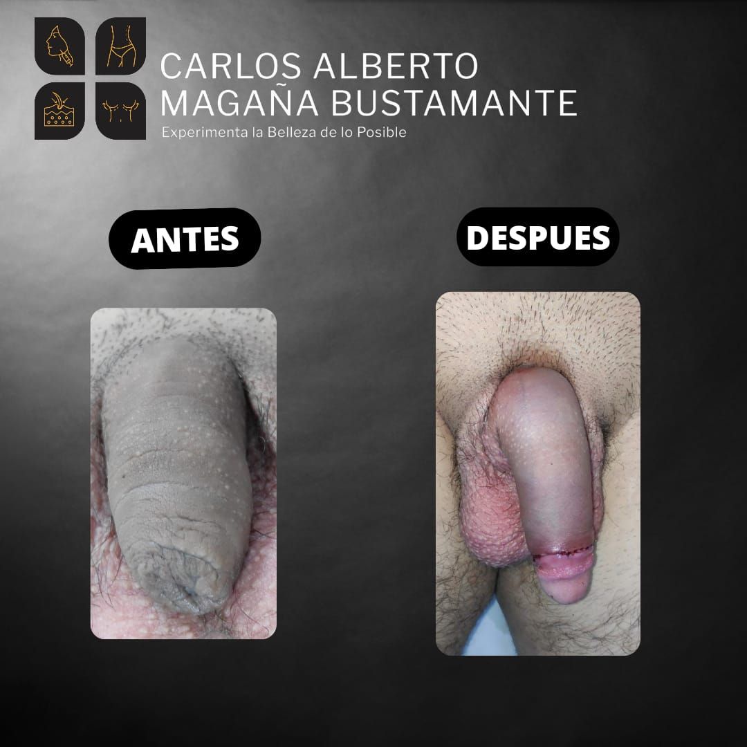 Carlos Alberto Magaña Bustamante-34
