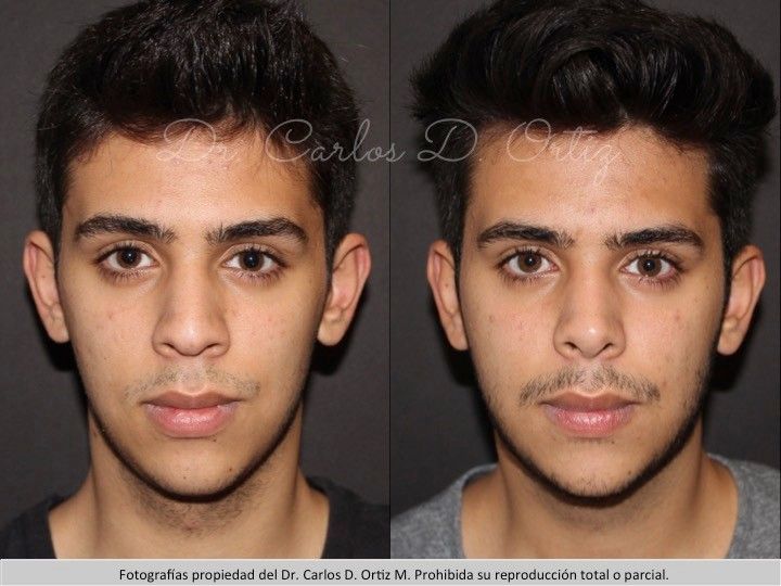 Carlos David Ortiz Moreno-11