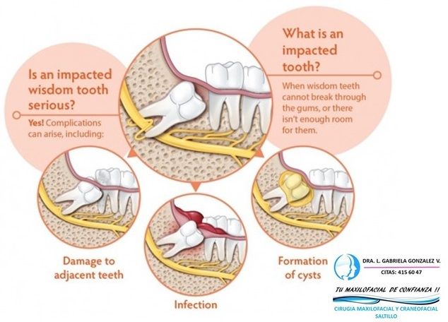 Laura Gabriela González Valdéz-50