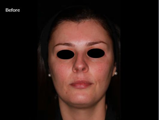 Jorge Luis Villalobos Ibarra-4