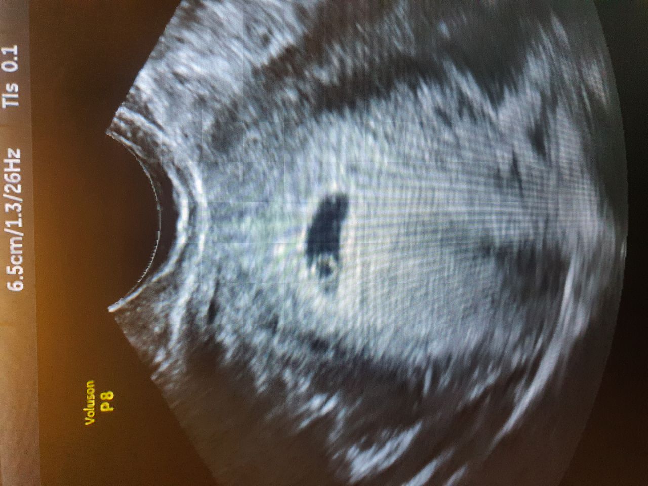 Nancy L. Roman Estrada-48