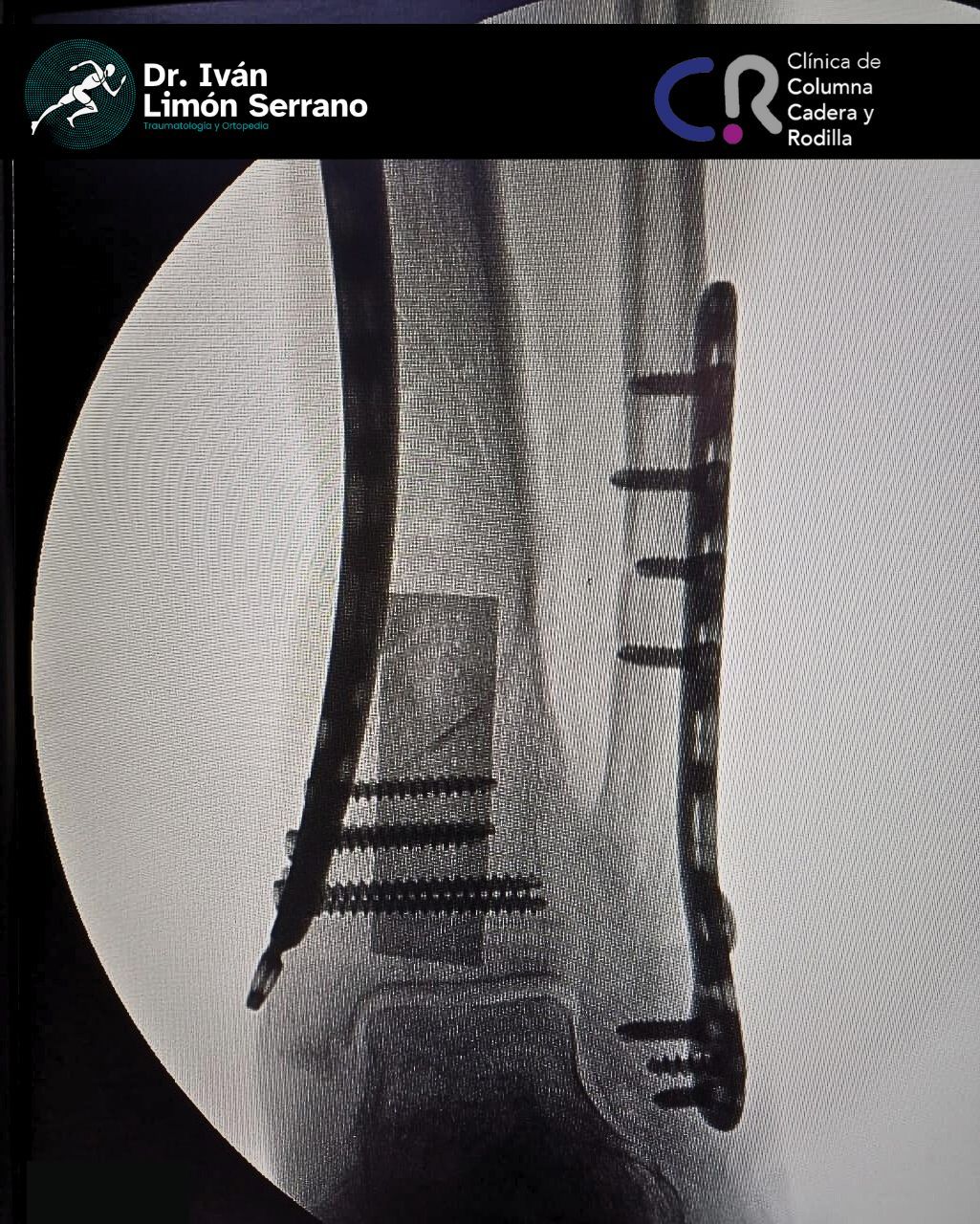 Iván Limón Serrano-44