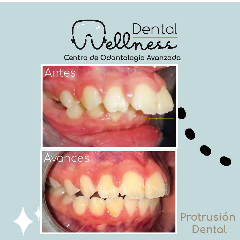 Leticia Hernández-27