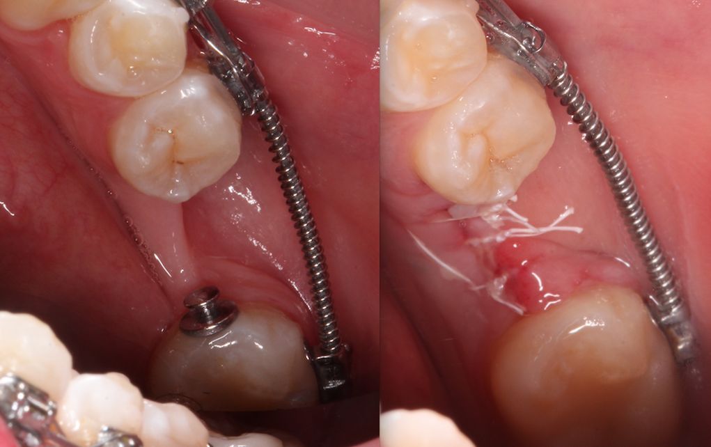 María Guadalupe García Figueroa-9