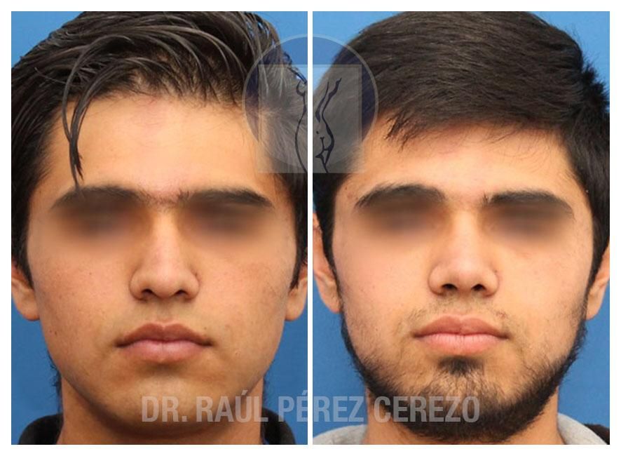 Raúl Pérez Cerezo-18