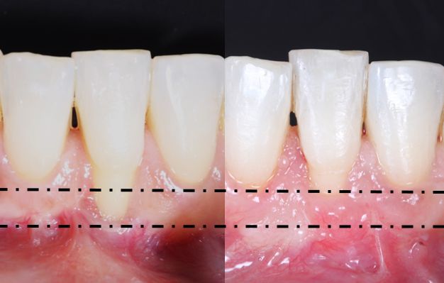 Ireri Rojas Bermúdez-10