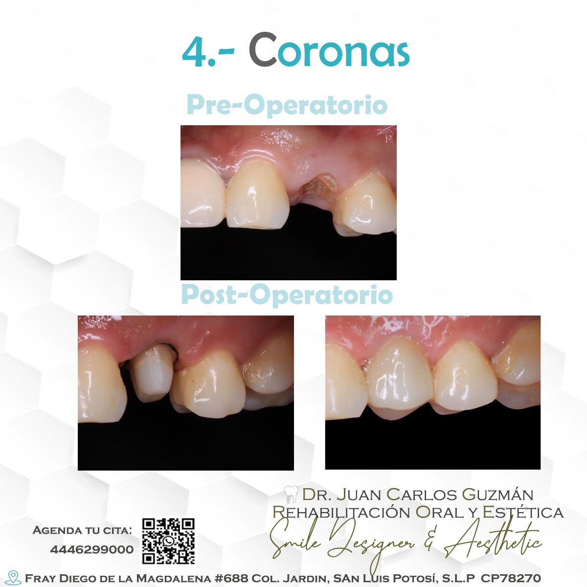 Juan Carlos Guzmán Castañeda-4