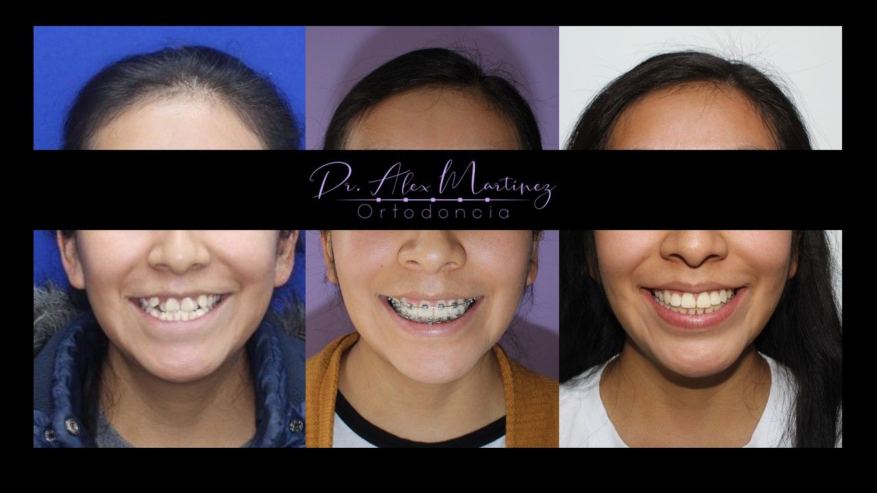 Alejandro Martínez Hernández-3