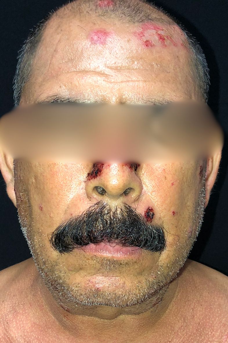 Lauro Francisco Varela Coronado-20