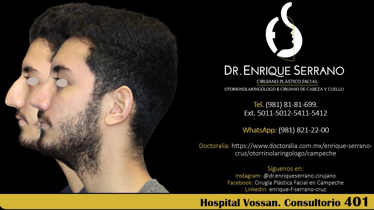 Enrique Serrano Cruz-144