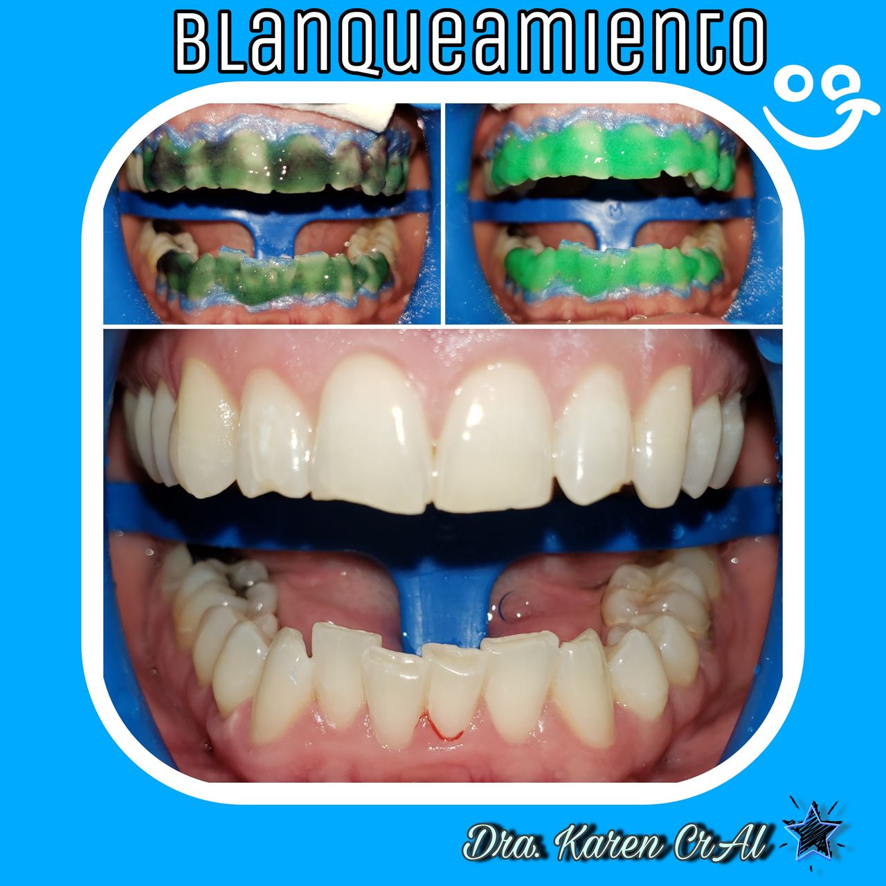 Ana Karen Cruz Altamirano-6