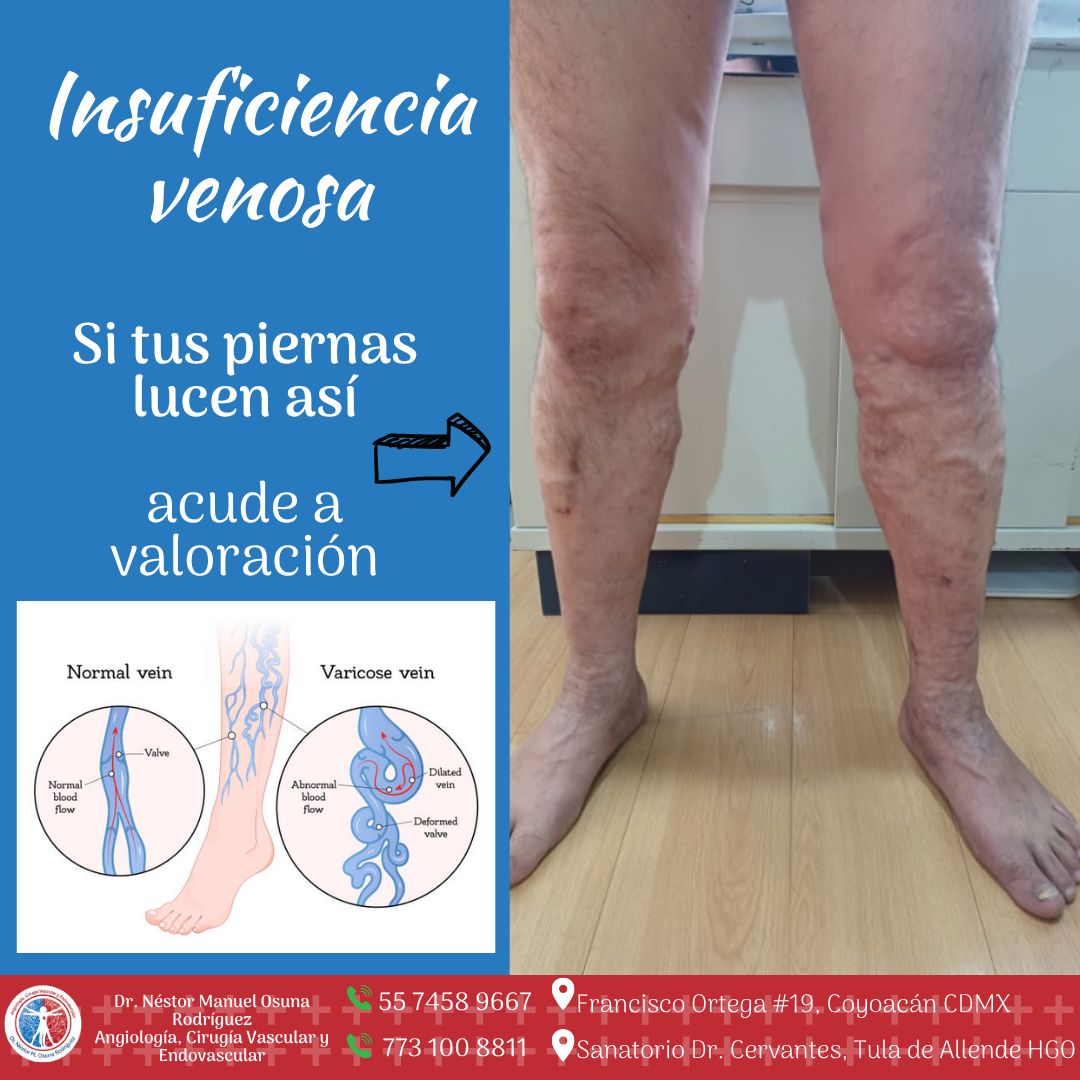 Nestor Manuel Osuna Rodriguez-12