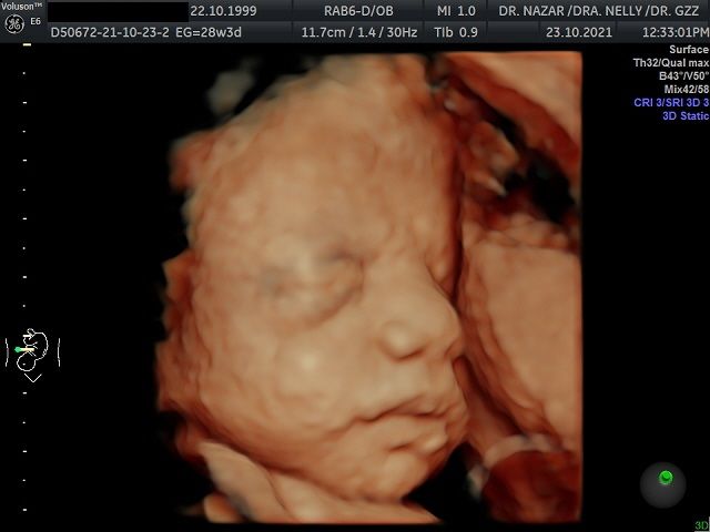 Miguel Angel González Nazar-8