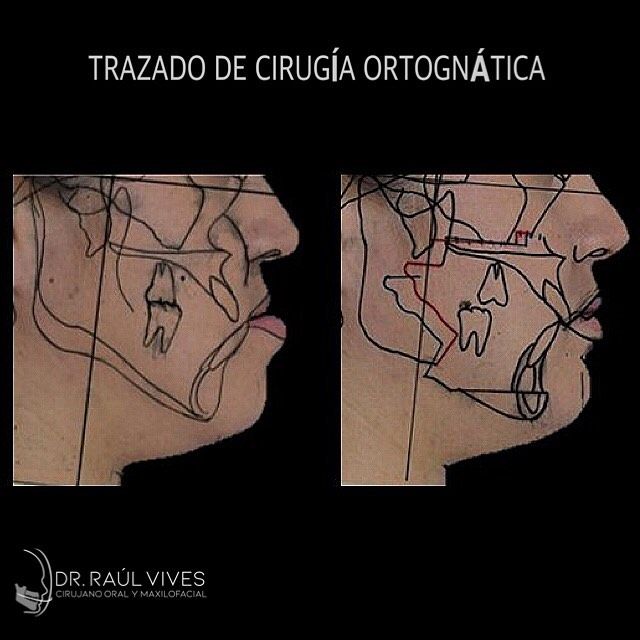 Raúl José Vives Serrano-0