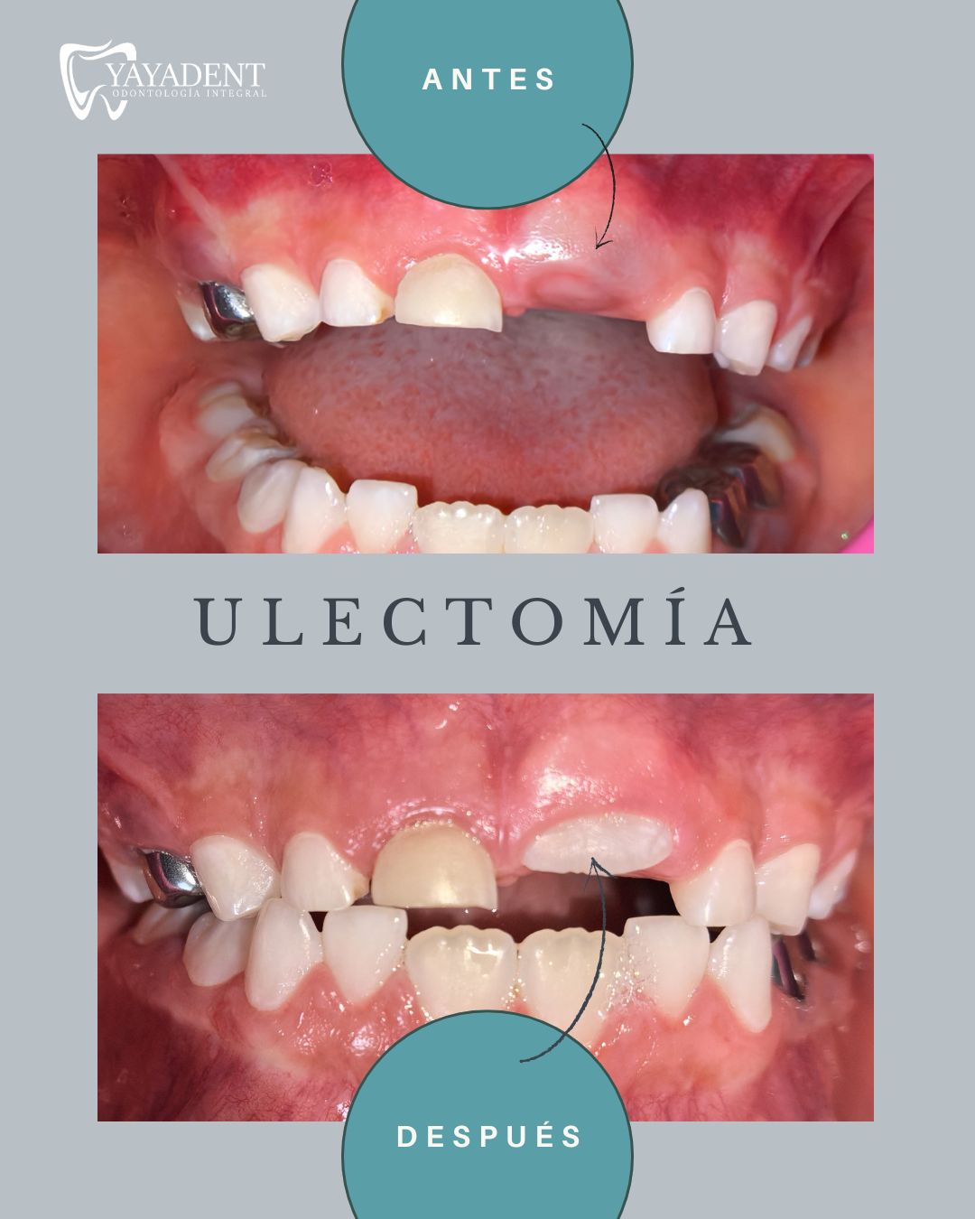 Sibely Yaraset Aranda Rodríguez-3