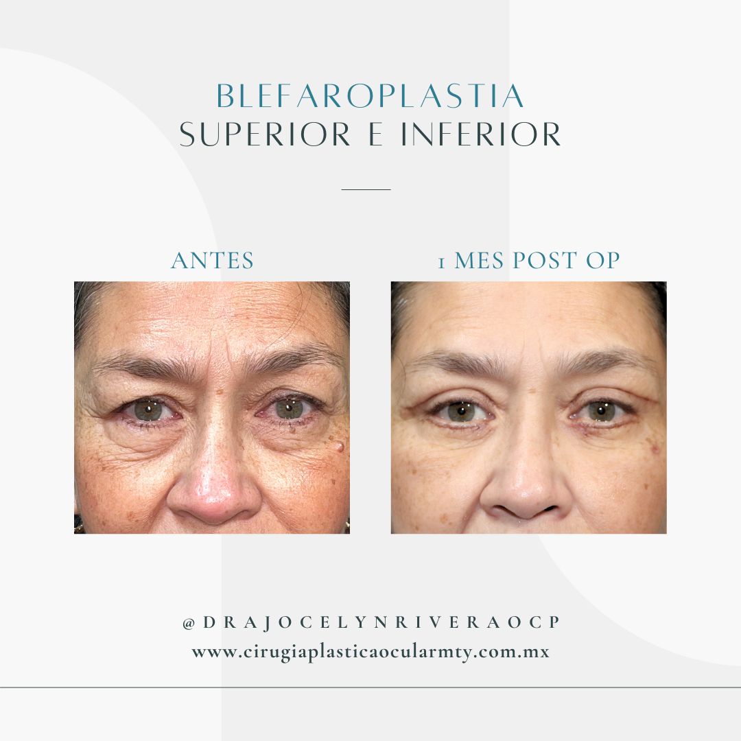 Ivonne Jocelyn Rivera Alvarado-0