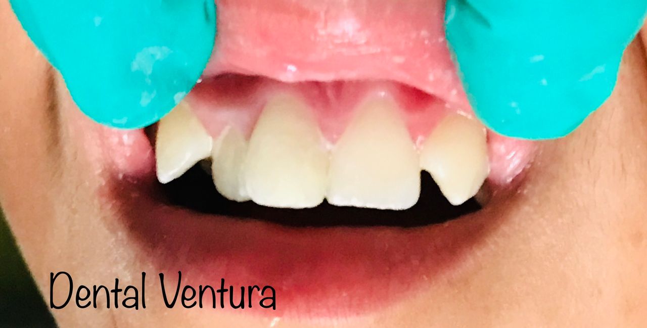 Antonio Cerda Ventura-18