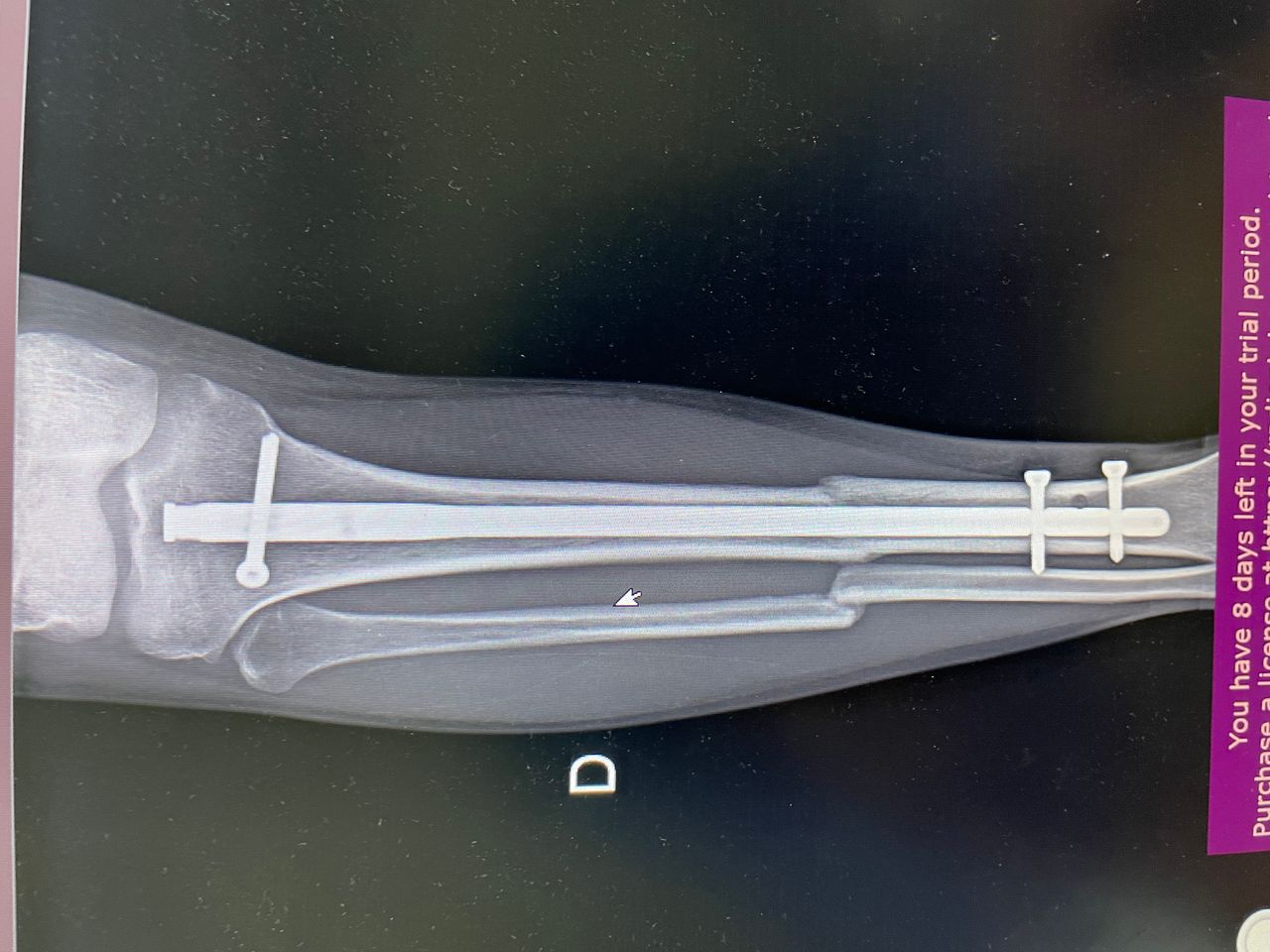 Luis Alberto Monge Bravo-8