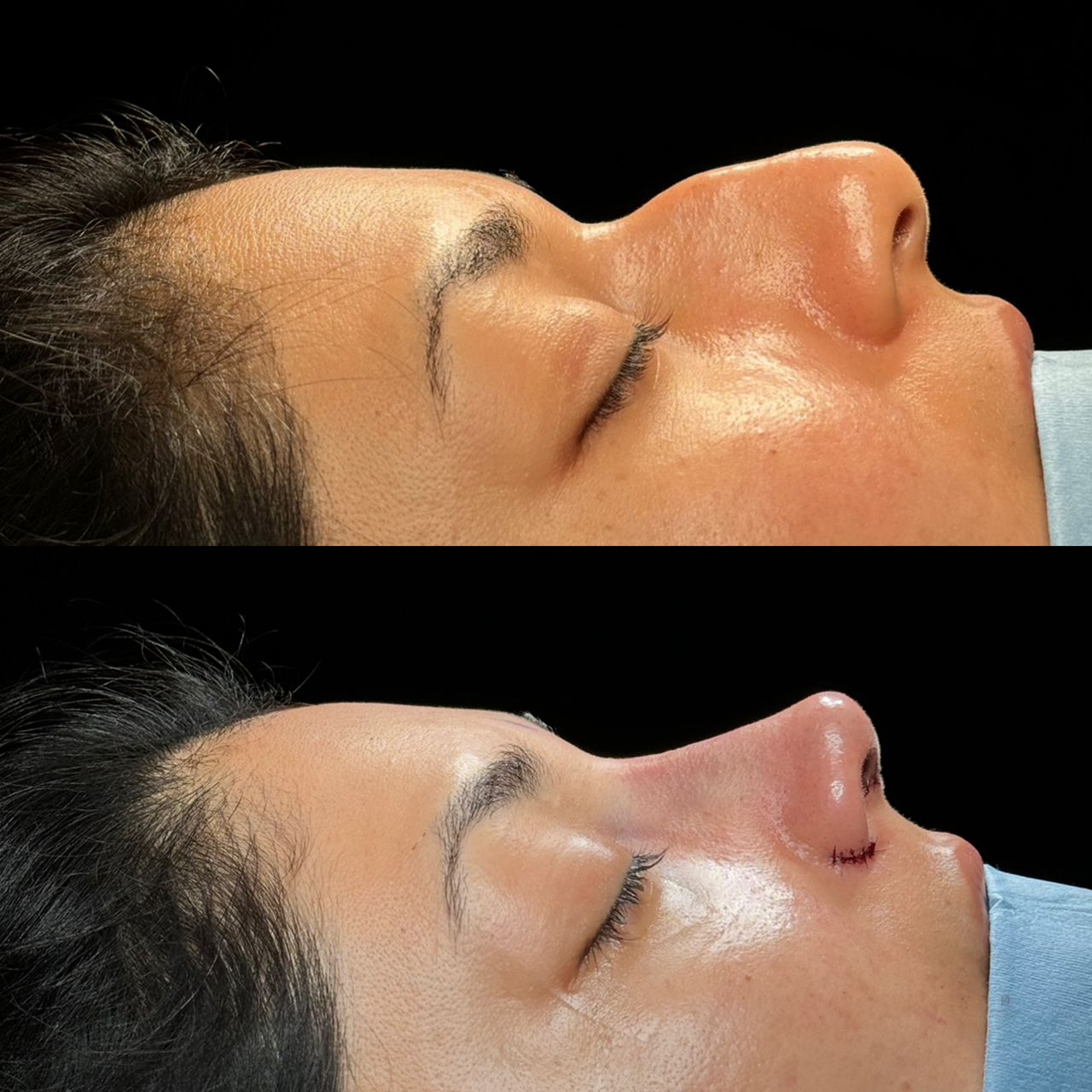 Angel Castro Urquizo-11