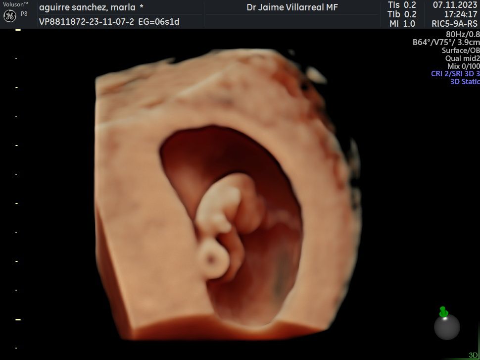 Jaime Alberto Villarreal Lopez-8