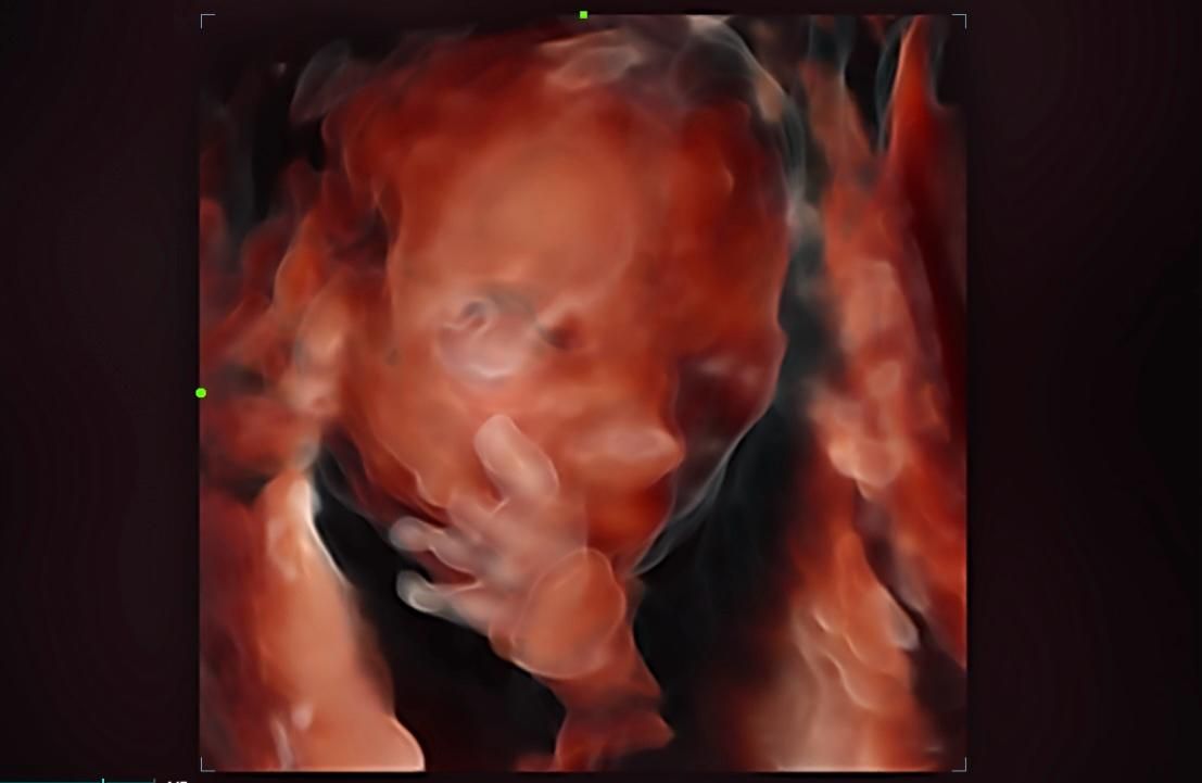 María Fernanda Rangel Orozco-1