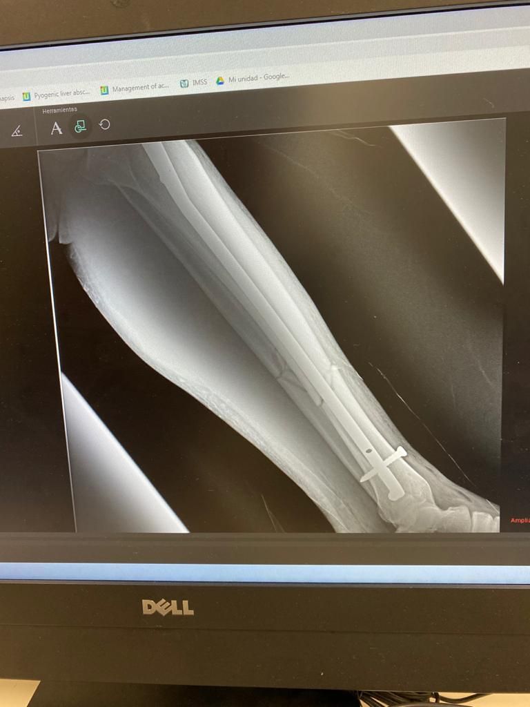 Jeftte Aaron Chacon Martinez-17