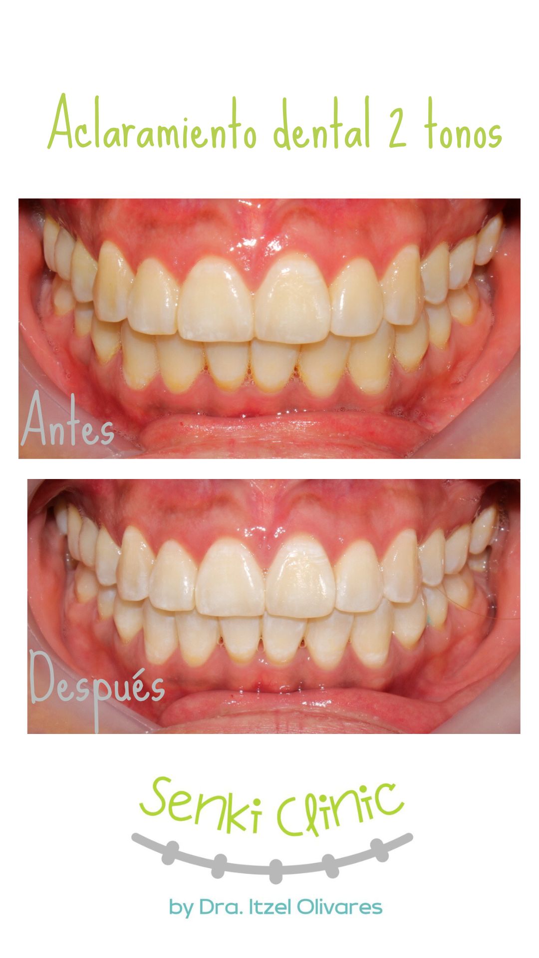 Itzel Olivares Lara-18