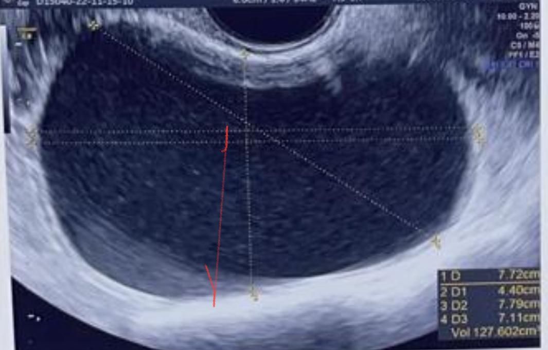 Ernesto Peimbert Puente-3