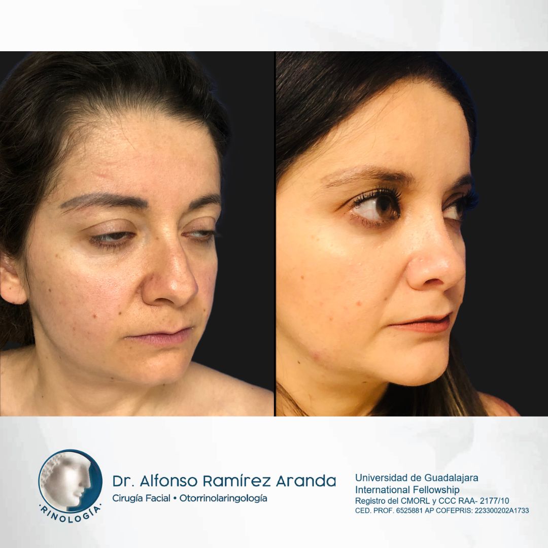 Alfonso Ramírez Aranda-19