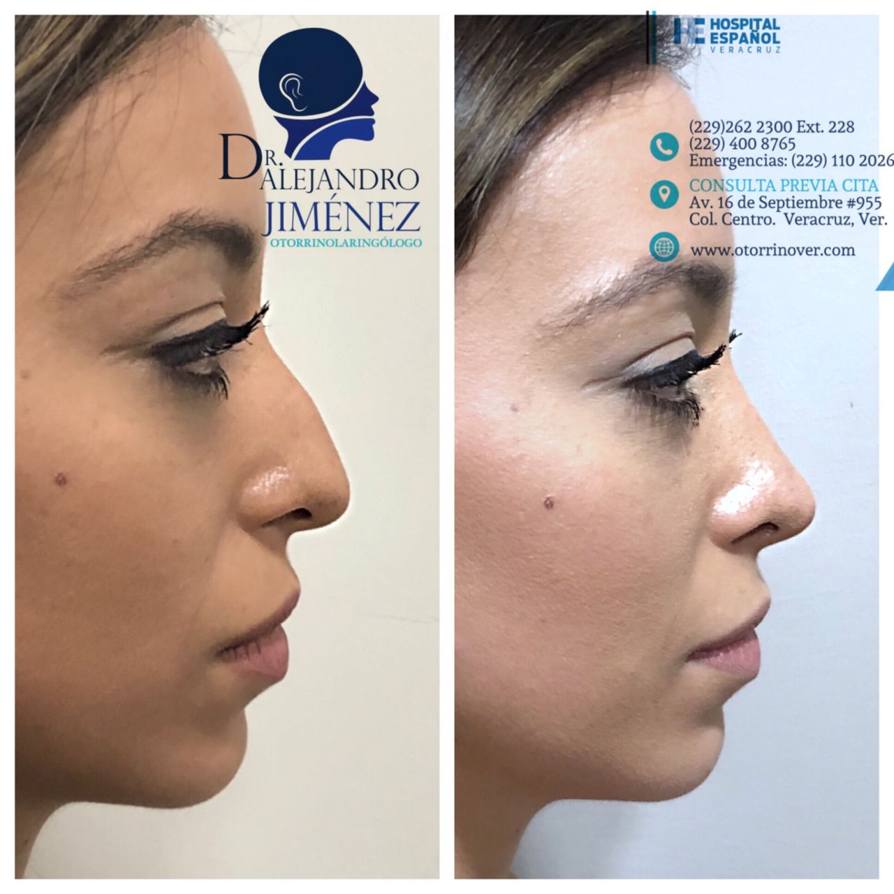 Alejandro Jimenez Garcia-13