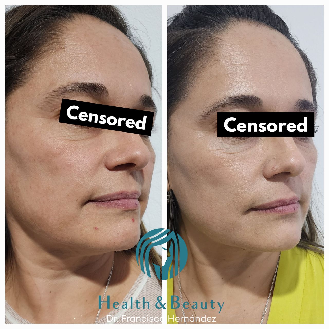 Francisco Hernández Gómez Crespo-70