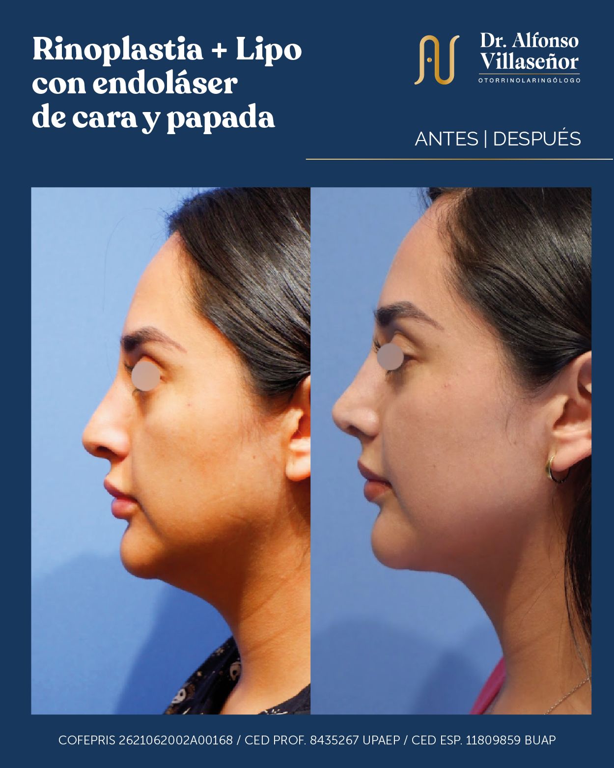 Alfonso Villaseñor Herrero-3