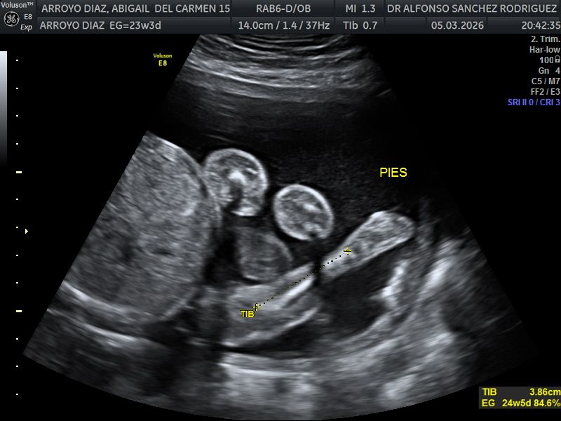 Alfonso Sanchez Rodriguez-62