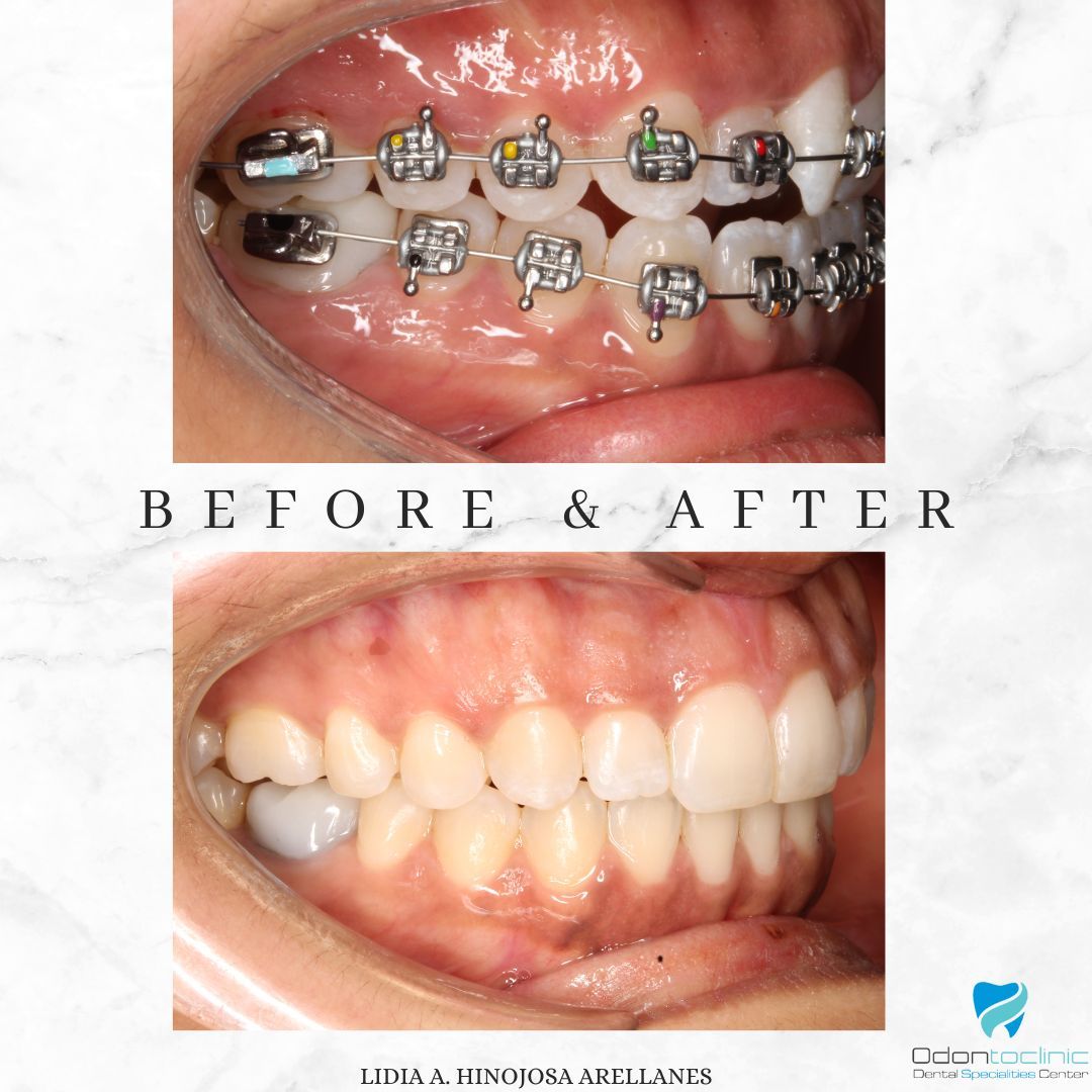 Lidia Abigail Hinojosa Arellanes-20