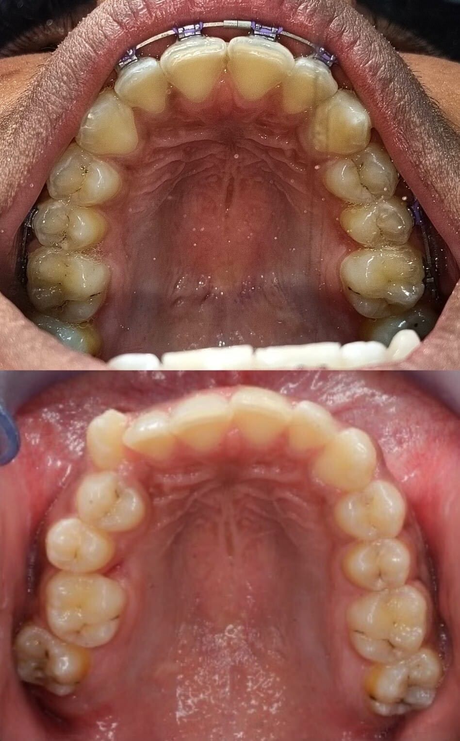 Luz Anel Valente Lozano-6