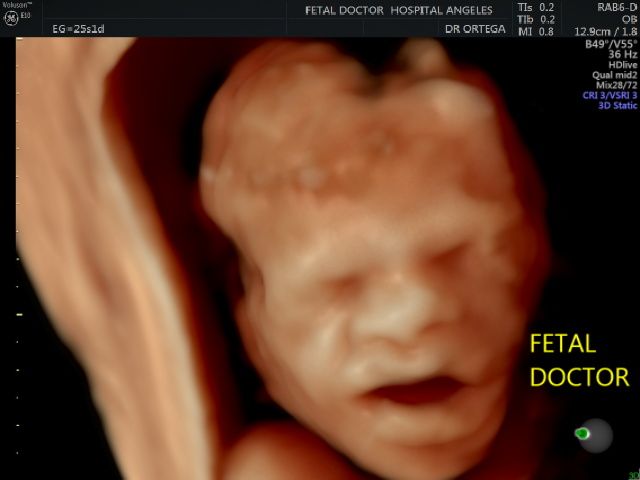 Jesús Manuel Ortega Flores-14