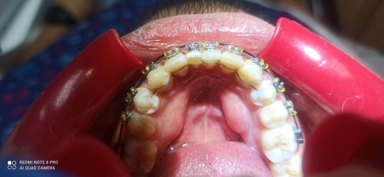 Oscar Cortez Perez-13