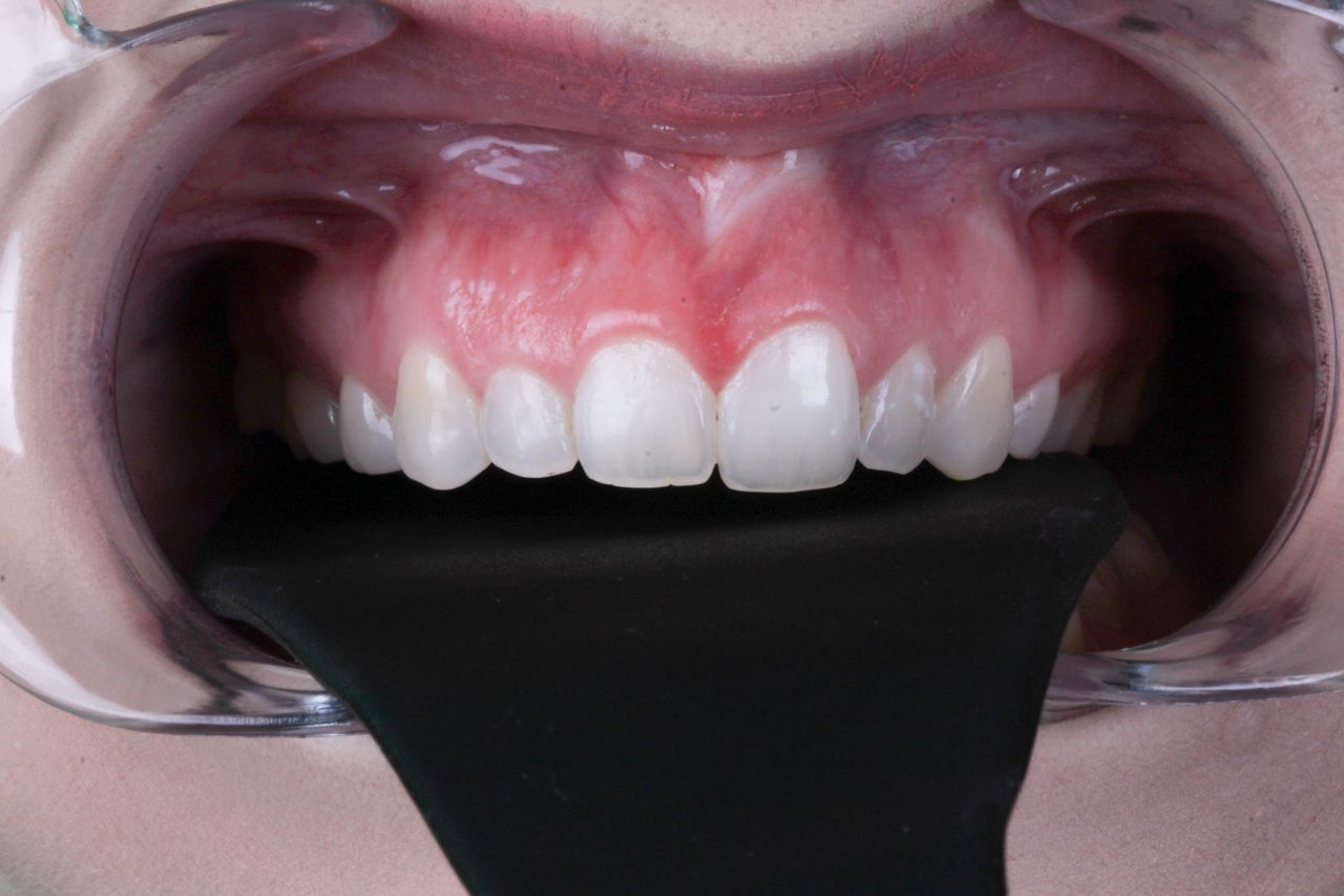 Hugo Enrique Aguilar Lamas-97