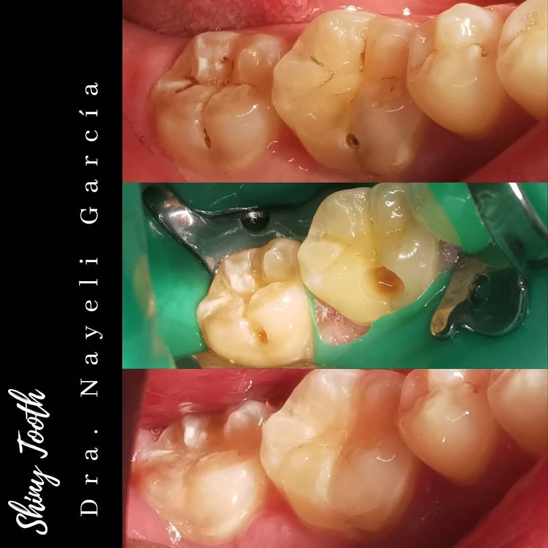 Nayeli Garcia Morales-46