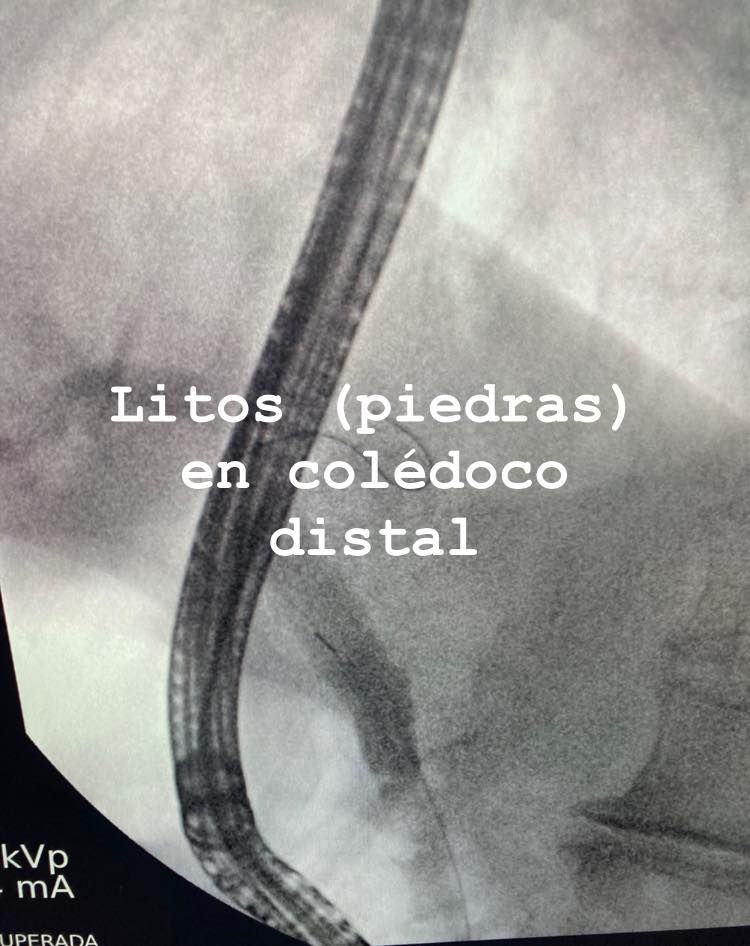 J. César Reyes Vásquez-16